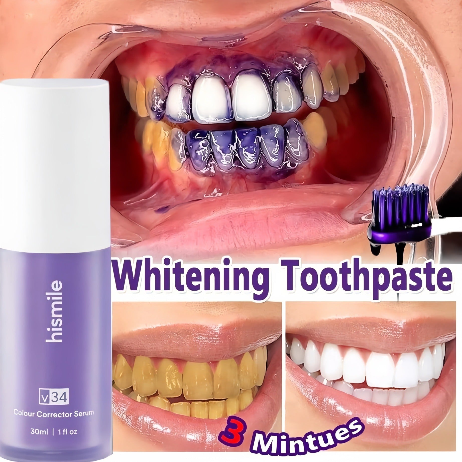 Hismile V34 Colour Corrector Serum – Instant Purple Teeth Whitening Solution (30ml)
